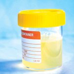 urine-sample